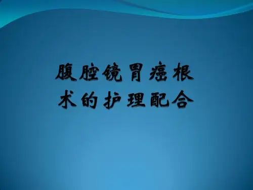 腹腔镜胃癌根治术手术配合PPT