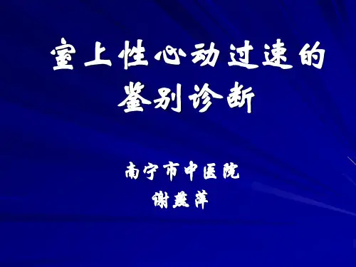 室上性心动过速和鉴别诊断