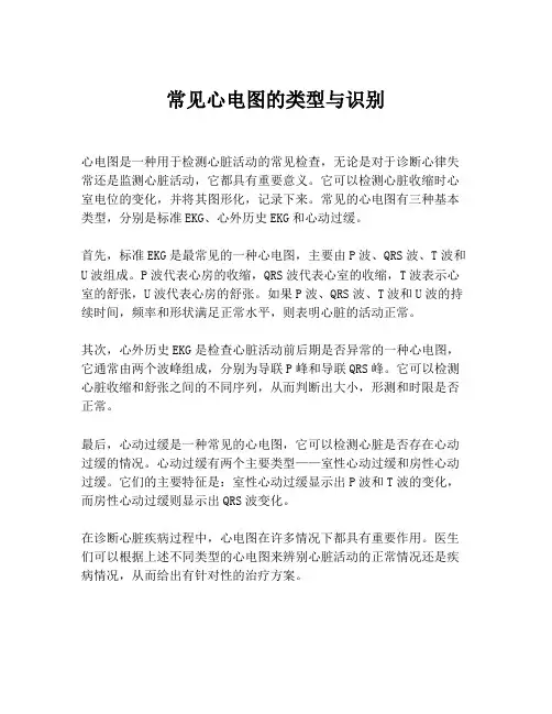 常见心电图的类型与识别