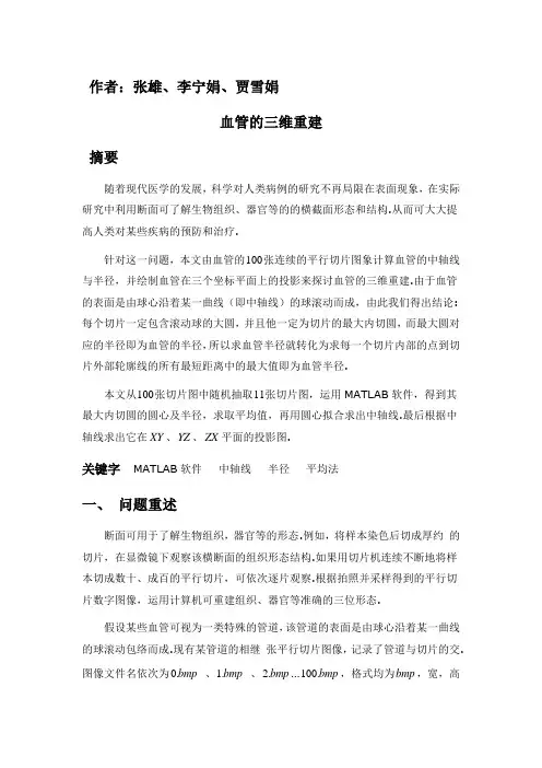 血管的三维重建