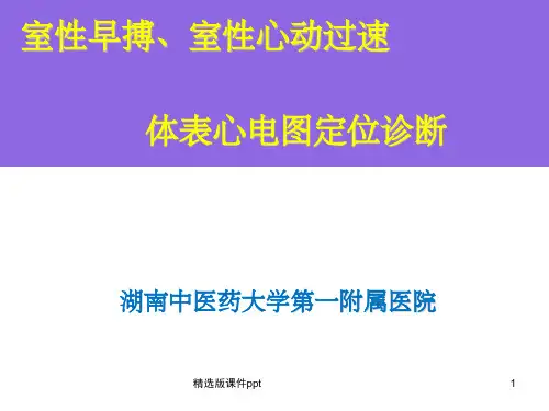 室性早搏、室性心动过速的体表心电图定位诊断