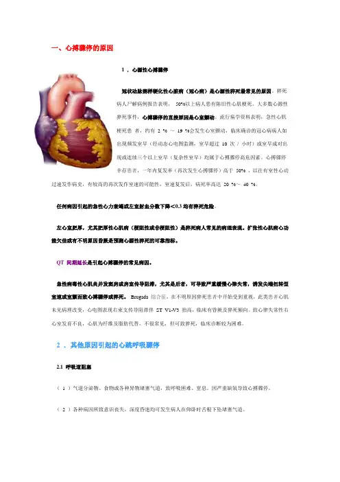 心搏骤停