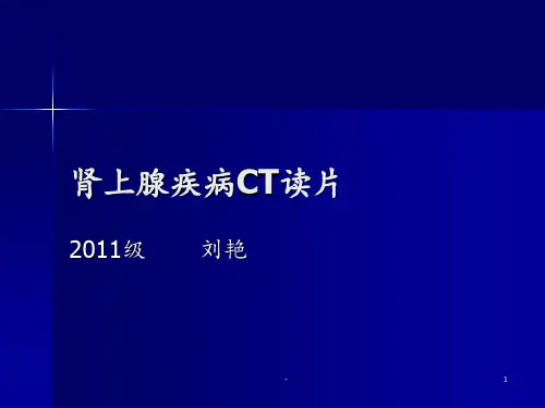 肾上腺疾病CT读片ppt课件