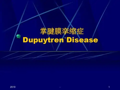掌腱膜挛缩症ppt课件