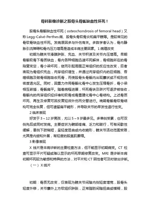 骨科影像诊断之股骨头骨骺缺血性坏死！