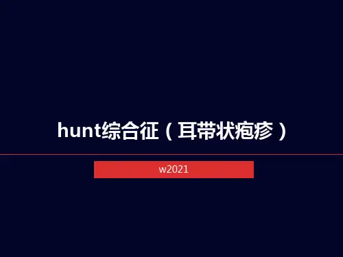 hunt综合征(耳带状疱疹)