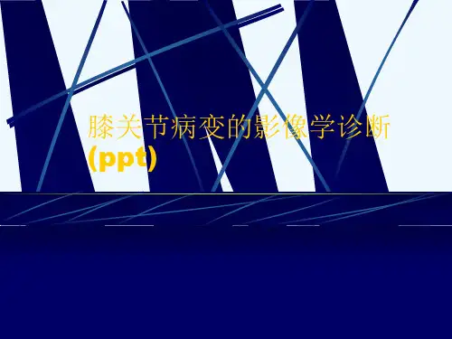 膝关节病变的影像学诊断(ppt)