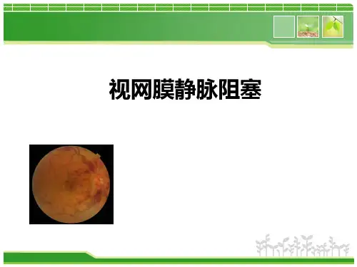 视网膜静脉阻塞PPT课件