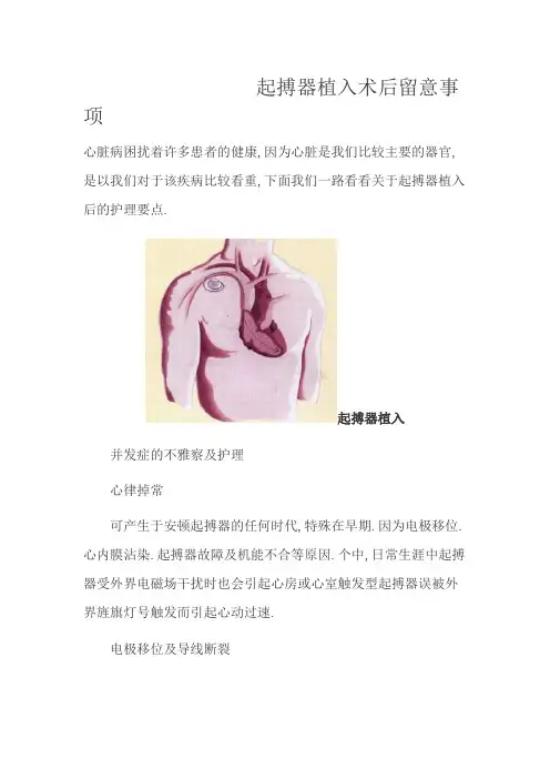 起搏器植入术后注意事项