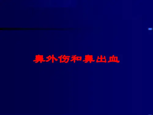 鼻外伤和鼻出血培训课件