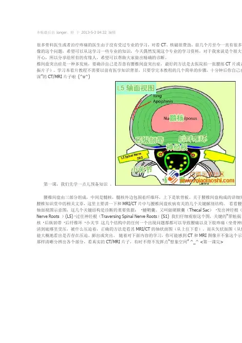 脊柱CT(MR)图解