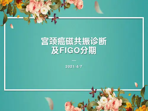 宫颈癌MR诊断与GIOG分期