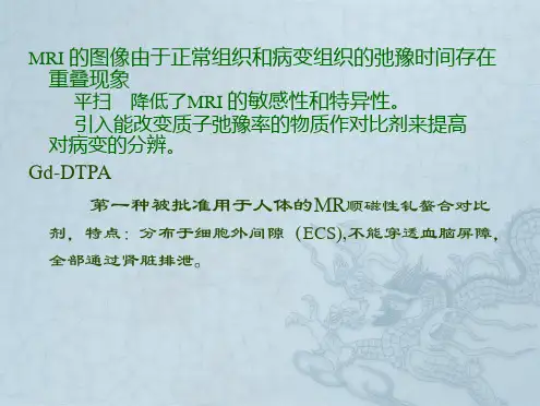 Gd-BOPTA在肝脏病变中应用