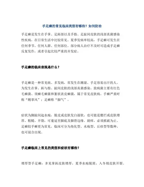 手足癣的常见临床类型有哪些？如何防治