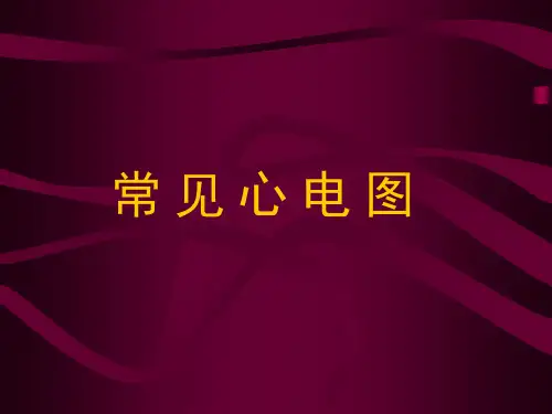 常见心电图ppt课件