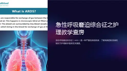 急性呼吸窘迫综合征之护理教学查房