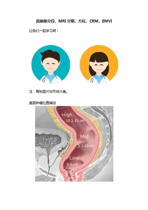 直肠癌分段、MRI分期、方位、CRM、EMVI