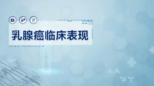 乳腺癌临床表现
