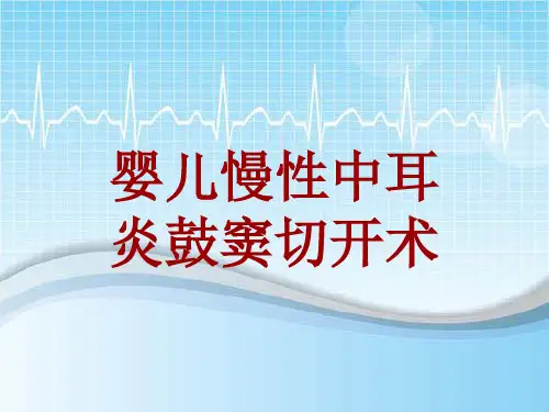 手术讲解模板：婴儿慢性中耳炎鼓窦切开术