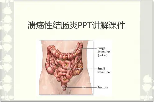 溃疡性结肠炎PPT讲解课件