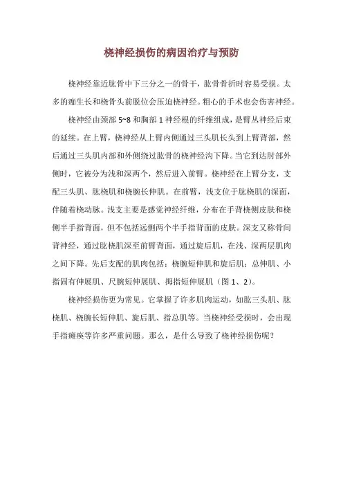 桡神经损伤的病因治疗与预防
