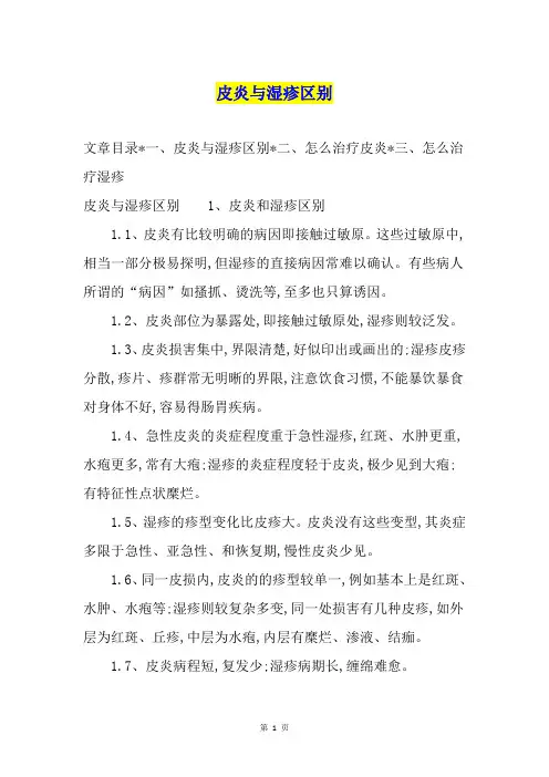 皮炎与湿疹区别
