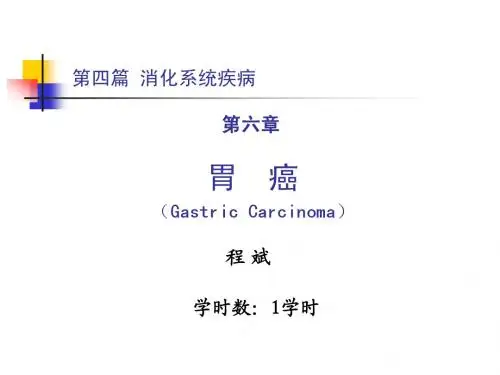 第六章 胃癌