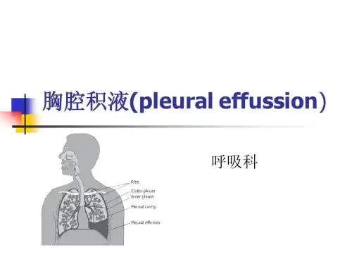 胸腔积液