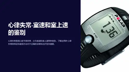 心律失常-室速和室上速的鉴别