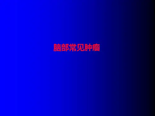 脑部常见肿瘤影像学表现ppt课件