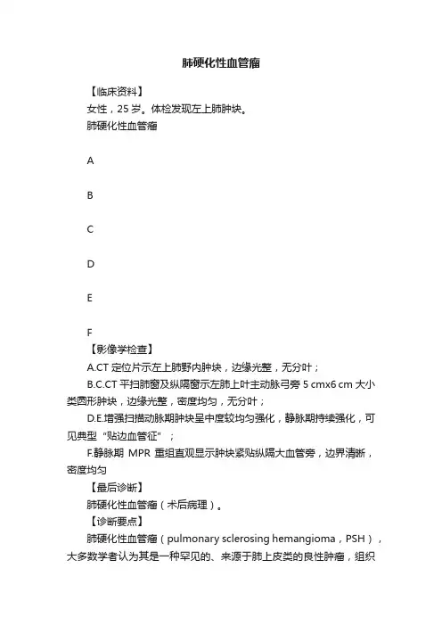 肺硬化性血管瘤