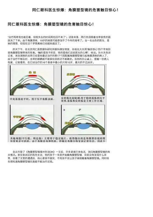 同仁眼科医生惊爆：角膜塑型镜的危害触目惊心！