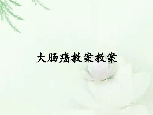 大肠癌教案教案