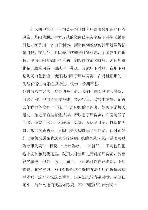 火针艾灸彻底治愈甲沟炎的最简单疗法