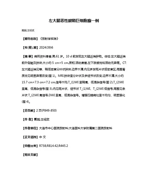 左大腿恶性腱鞘巨细胞瘤一例