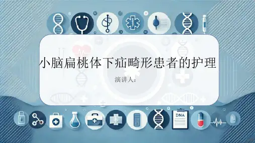 小脑扁桃体下疝畸形患者的护理