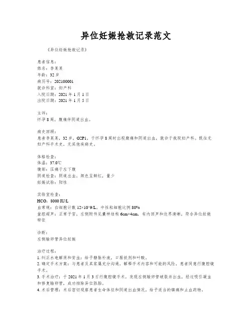 异位妊娠抢救记录范文