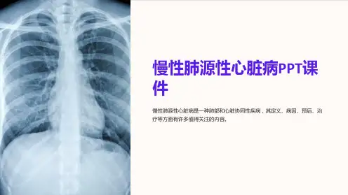 《慢性肺源性心脏病》课件