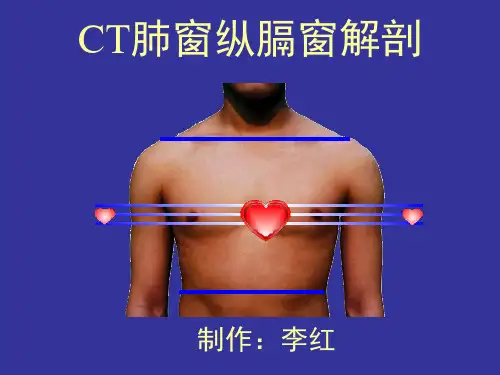 CT肺窗横断层解剖PPT演示幻灯片