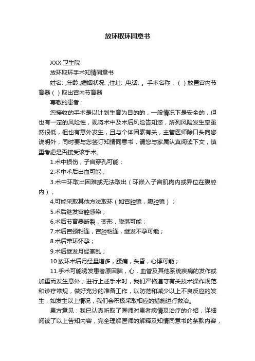 放环取环同意书