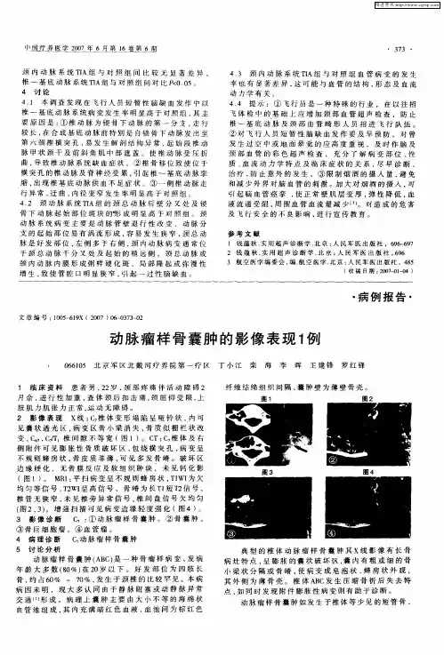 动脉瘤样骨囊肿的影像表现1例
