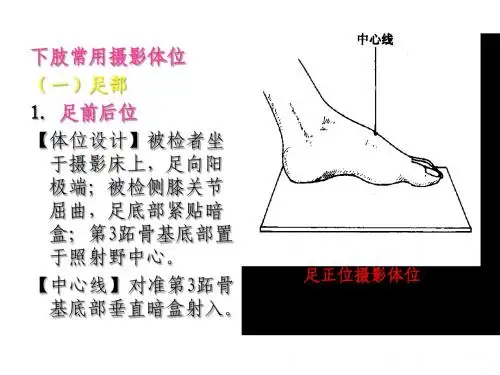 3.四肢X线技术之足、踝