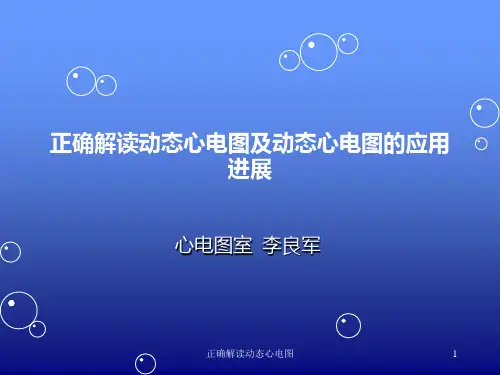 正确解读动态心电图ppt课件