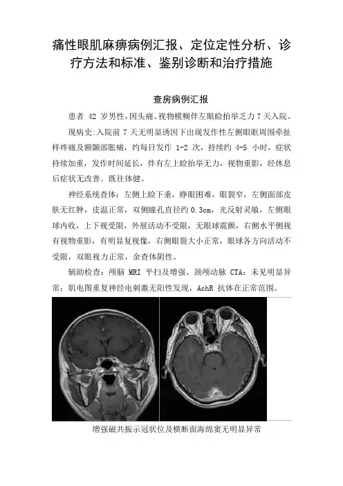 痛性眼肌麻痹病例汇报、定位定性分析、诊疗方法和标准、鉴别诊断和治精品