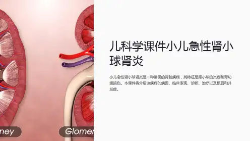 儿科学课件小儿急性肾小球肾炎