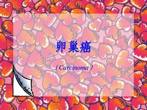 卵巢癌