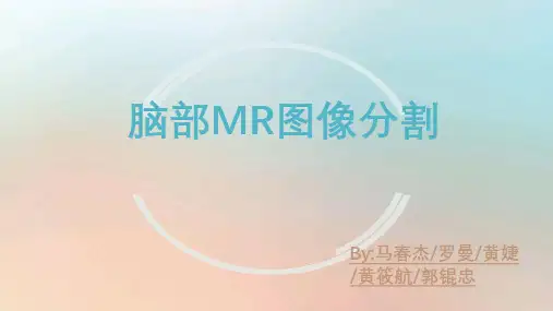 3.3脑部MR图像分割