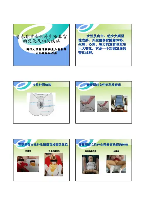 女童生殖系统疾病与保健