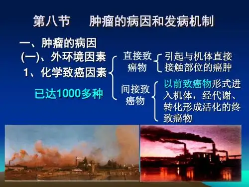 《肿瘤的病因》PPT课件ppt课件