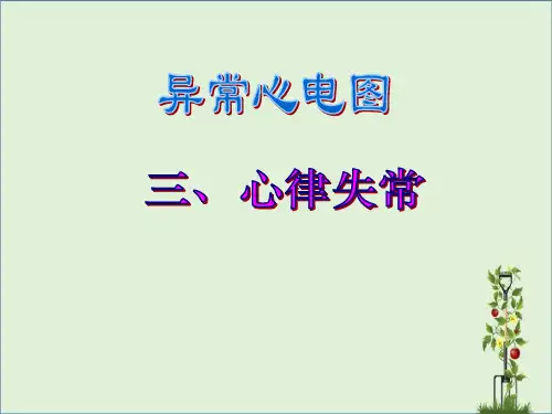 -异常心电图图谱汇总